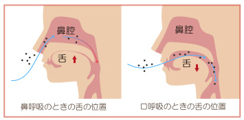 正しい舌の位置と口呼吸の時の舌の位置