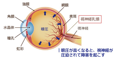 眼球図